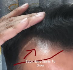 Best Hair Oil in Pakistan for Hair Growth – Regrowth Hair Oil