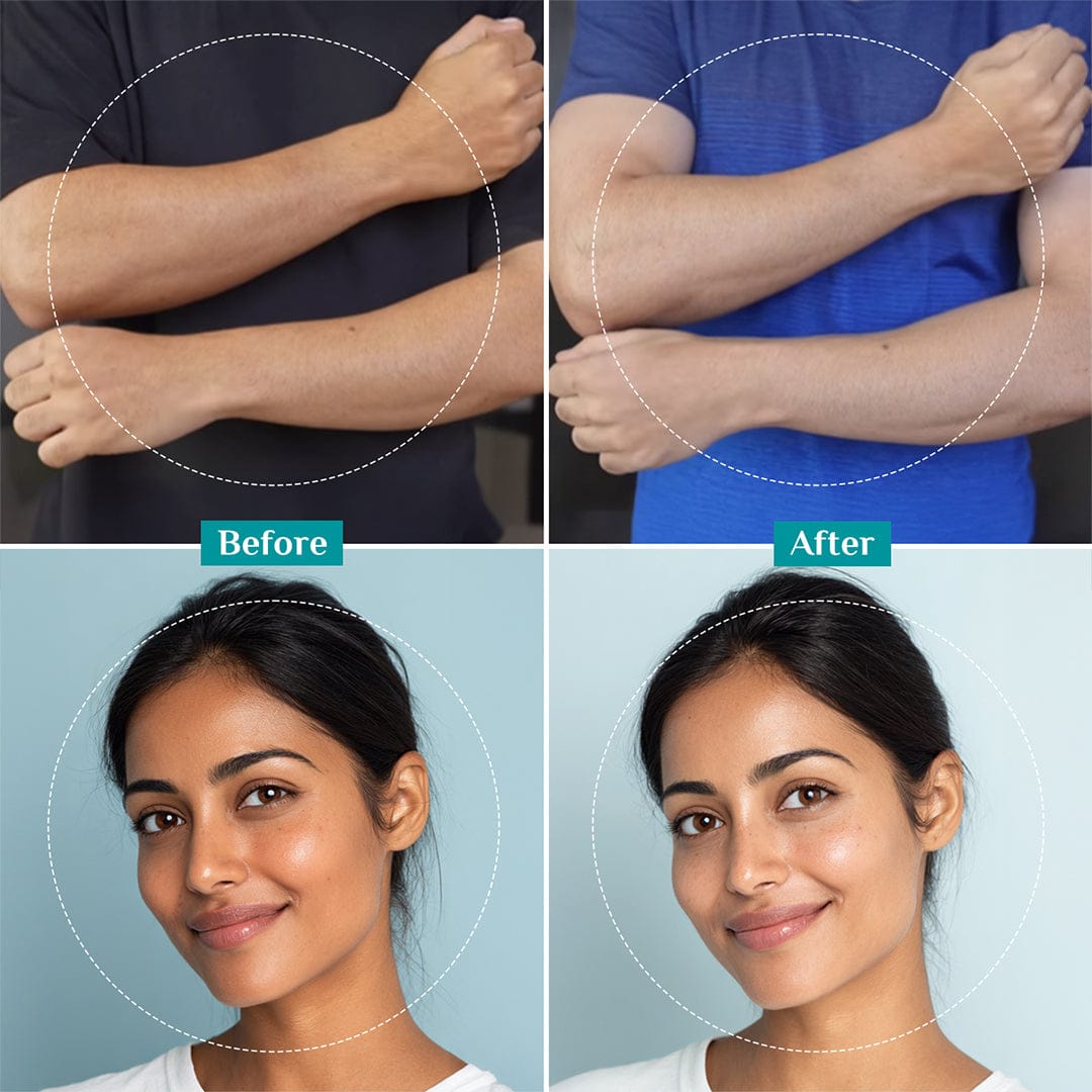 Pilgrim Pelling Solution